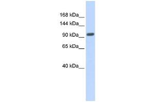 WB Suggested Anti-ZNF512B Antibody Titration: 0. (ZNF512B anticorps  (Middle Region))