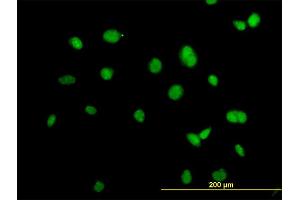 Immunofluorescence of monoclonal antibody to ACTN4 on HeLa cell.