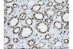 Immunohistochemical staining of paraffin-embedded Human liver tissue using anti-TBXAS1 mouse monoclonal antibody. (TBXAS1 anticorps)