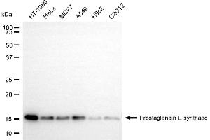 Western blotting analysis using prostaglandin E synthase antibody (ABIN7799933).