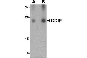 Western Blotting (WB) image for anti-LITAF-Like Protein (CDIP1) (Middle Region) antibody (ABIN1030904) (CDIP1 anticorps  (Middle Region))