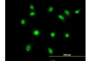 Immunofluorescence of monoclonal antibody to LDB2 on HeLa cell. (LIM Domain Binding 2 Protein anticorps  (AA 1-373))
