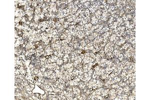 IHC analysis of EIF3C using anti-EIF3C antibody (ABIN7602528). (EIF3C anticorps  (AA 81-637))