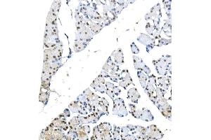IHC analysis of METTL1 using anti-METTL1 antibody (ABIN7600484).
