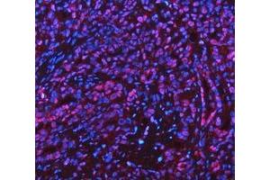 anti-Adenosine Kinase (ADK) (AA 165-351) antibody