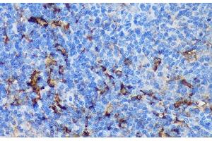 Immunohistochemistry of paraffin-embedded Mouse spleen using PADI4 Polyclonal Antibody at dilution of 1:100 (40x lens).