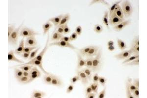 ICC testing of FFPE human A549 cells with DDB1 antibody. (DDB1 anticorps  (AA 1011-1140))