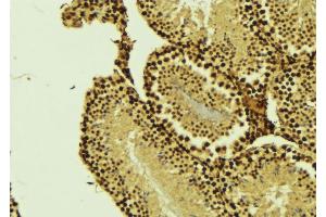 ABIN6276363 at 1/100 staining Mouse testis tissue by IHC-P. (CARD8 anticorps)