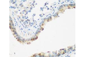 Immunohistochemistry of paraffin-embedded Mouse lung using IGF2BP3 Polyclonal Antibody at dilution of 1:200 (40x lens). (IGF2BP3 anticorps)