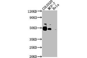 Western Blot Positive WB detected in: COLO320 whole cell lysate, MCF-7 whole cell lysate, Hela whole cell lysate All lanes: KRT20 antibody at 1:2000 Secondary Goat polyclonal to rabbit IgG at 1/50000 dilution Predicted band size: 49 kDa Observed band size: 49 kDa (Keratin 2 anticorps  (AA 207-424))
