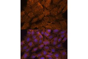 Immunofluorescence analysis of C6 cells using TNFL2 antibody (ABIN6133093, ABIN6149298, ABIN6149299 and ABIN6217788) at dilution of 1:100. (TNFAIP8L2 anticorps  (AA 1-184))