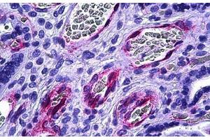 Human Placenta, Vessels: Formalin-Fixed, Paraffin-Embedded (FFPE) (BMX anticorps  (AA 11-60))