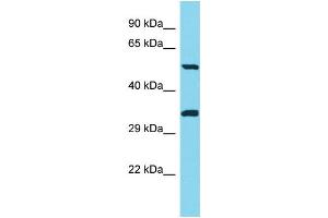Host: Rabbit Target Name: PNLIPRP3 Sample Type: Jurkat Whole Cell lysates Antibody Dilution: 1.