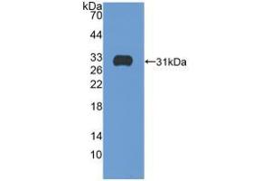 Western blot analysis of recombinant Human ITGb5. (Integrin beta 5 anticorps  (AA 137-378))