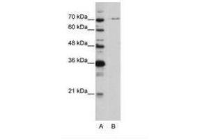 Image no. 1 for anti-PRP3 Pre-mRNA Processing Factor 3 Homolog (PRPF3) (AA 63-112) antibody (ABIN6736204) (PRPF3 anticorps  (AA 63-112))