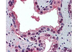 Anti-PABPN1 antibody IHC of human prostate. (PABPN1 anticorps  (N-Term))
