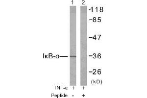 Image no. 2 for anti-Nuclear Factor of kappa Light Polypeptide Gene Enhancer in B-Cells Inhibitor, alpha (NFKBIA) (Tyr42) antibody (ABIN197391) (NFKBIA anticorps  (Tyr42))