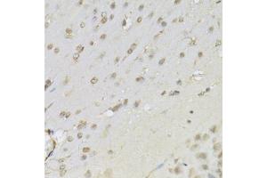 Immunohistochemistry of paraffin-embedded mouse brain using RUNX1 Antibody (ABIN5971086) at dilution of 1/100 (40x lens). (RUNX1 anticorps)