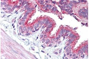 Anti-CCNE1 / Cyclin E1 antibody IHC staining of human-lung.