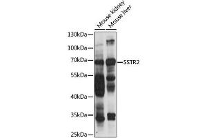 Western blot analysis of extracts of various cell lines, using SSTR2 antibody (ABIN6291365) at 1:1000 dilution. (SSTR2 anticorps)
