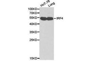 Western Blotting (WB) image for anti-Interferon Regulatory Factor 4 (IRF4) antibody (ABIN1873272) (IRF4 anticorps)