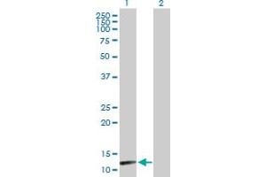 Western Blot analysis of NUDT8 expression in transfected 293T cell line by NUDT8 MaxPab polyclonal antibody. (NUDT8 anticorps  (AA 1-140))