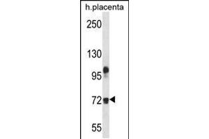 Western blot analysis in human placenta tissue lysates (35ug/lane). (Fibulin 1 anticorps  (C-Term))