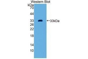 Detection of Recombinant GDF11, Human using Monoclonal Antibody to Growth Differentiation Factor 11 (GDF11) (GDF11 anticorps  (AA 138-386))