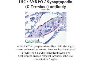 Image no. 1 for anti-Synaptopodin (SYNPO) (C-Term) antibody (ABIN1739830)