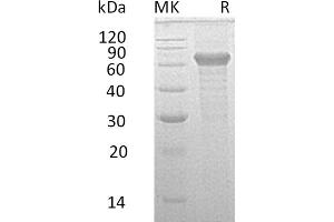 Greater than 95 % as determined by reducing SDS-PAGE.