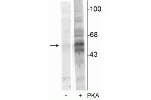 Western blot of recombinant tryptophan hydroxylase incubated in the absence (-) and presence (+) of cAMP-dependent protein kinase  showing specific immunolabeling of the ~55 kDa tryptophan hydroxylase protein phosphorylated at Ser58. (Tryptophan Hydroxylase 1 anticorps  (pSer58))