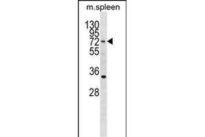 HIC2 Antibody (Center) (ABIN1538292 and ABIN2850037) western blot analysis in mouse spleen tissue lysates (35 μg/lane). (HIC2 anticorps  (AA 311-338))