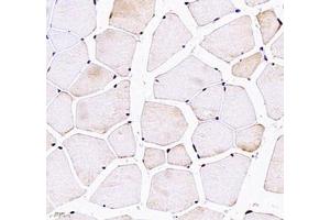 Immunohistochemistry of paraffin embedded mouse skeletal muscle using CNG1 (ABIN7073608) at dilution of 1:700 (400x lens)