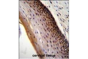 CCDC102A Antibody (C-term) (ABIN655241 and ABIN2844844) immunohistochemistry analysis in formalin fixed and paraffin embedded human cervical tissue followed by peroxidase conjugation of the secondary antibody and DAB staining.
