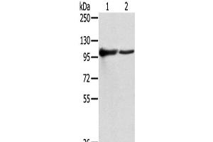 Western Blot analysis of K562 and A431 cells using TPX2 Polyclonal Antibody at dilution of 1/800 (TPX2 anticorps)