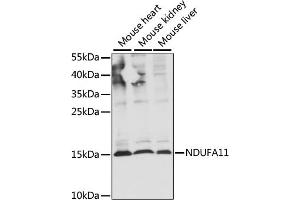 Western blot analysis of extracts of various cell lines, using NDUF antibody (ABIN7268798) at 1:1000 dilution. (NDUFA11 anticorps  (AA 1-100))