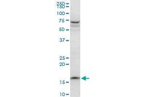 PPIL1 polyclonal antibody (A01), Lot # 060524JCS1.