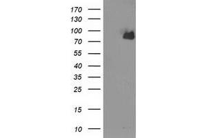 Western Blotting (WB) image for anti-Acyl-CoA Synthetase Short-Chain Family Member 2 (ACSS2) antibody (ABIN1496431) (ACSS2 anticorps)