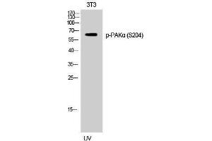 Western Blotting (WB) image for anti-P21-Activated Kinase 1 (PAK1) (pSer204) antibody (ABIN3173316) (PAK1 anticorps  (pSer204))