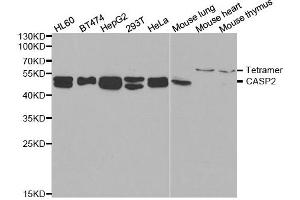 Western blot analysis of extracts of various cell lines, using CASP2 antibody. (Caspase 2 anticorps)