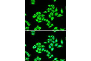 Immunofluorescence analysis of U2OS cells using TPD52L1 antibody (ABIN5973820). (TPD52L1 anticorps)