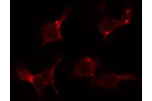 ABIN6279098 staining LOVO by IF/ICC. (AGXT2 anticorps  (Internal Region))