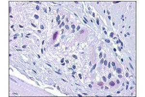 Human Colon, Myenteric Plexus: Formalin-Fixed, Paraffin-Embedded (FFPE) (Retinoblastoma Binding Protein 8 anticorps)