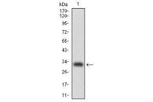 Image no. 1 for anti-CCAAT/enhancer Binding Protein (C/EBP), alpha (CEBPA) antibody (ABIN1497468) (CEBPA anticorps)