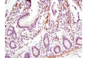 Immunohistochemical analysis of paraffin-embedded human small intestine using LPP mouse mAb with DAB staining.