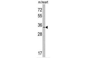 Western blot analysis of MLF1 Antibody (N-term) in mouse heart tissue lysates (35ug/lane). (MLF1 anticorps  (N-Term))
