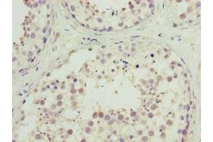 Immunohistochemistry of paraffin-embedded human testis tissue using ABIN7174711 at dilution of 1:100 (C10ORF91 anticorps  (AA 1-145))