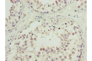 Immunohistochemistry of paraffin-embedded human testis tissue using ABIN7174711 at dilution of 1:100 (TMEM234 anticorps  (AA 1-145))