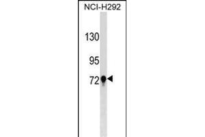 TGM3 Antibody (C-term) (ABIN1537448 and ABIN2849136) western blot analysis in NCI- cell line lysates (35 μg/lane). (TGM3 anticorps  (C-Term))