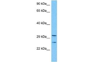 Host:  Mouse  Target Name:  TAL1  Sample Tissue:  Mouse Kidney  Antibody Dilution:  1ug/ml (TAL1 anticorps  (Middle Region))